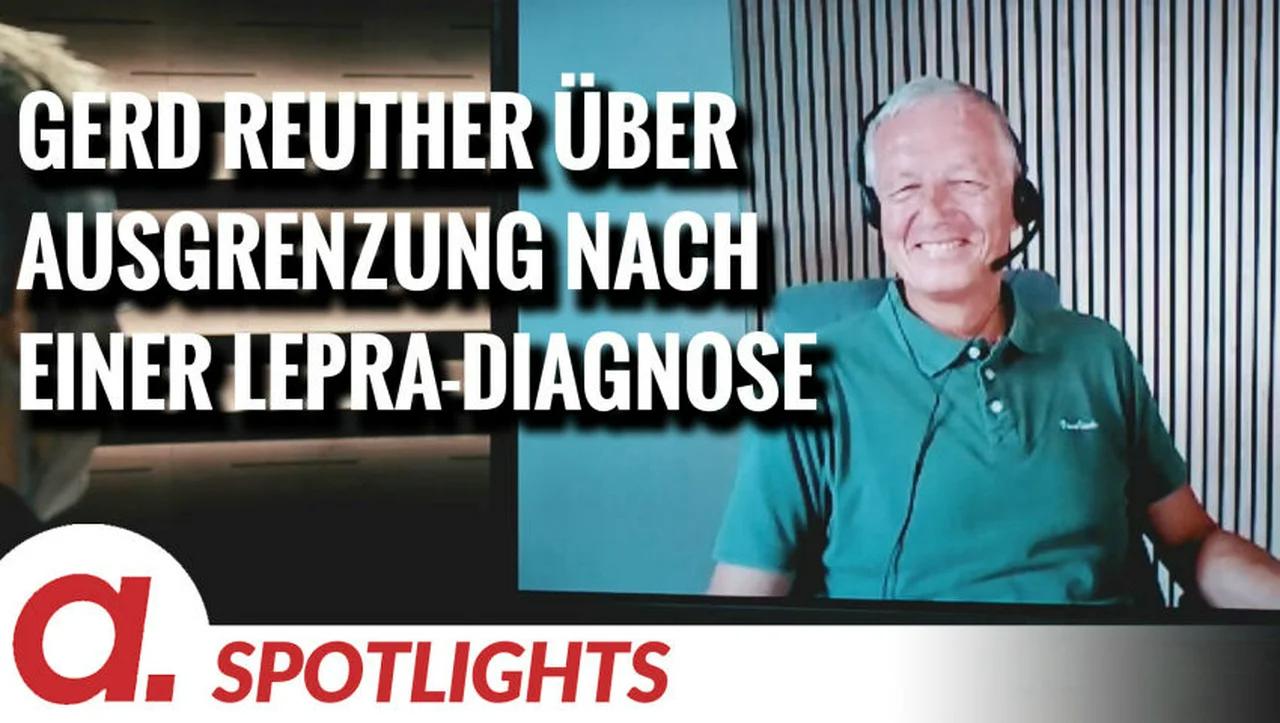 ⁣Spotlight: Gerd Reuther über die soziale Ausgrenzung nach einer Lepra-Diagnose