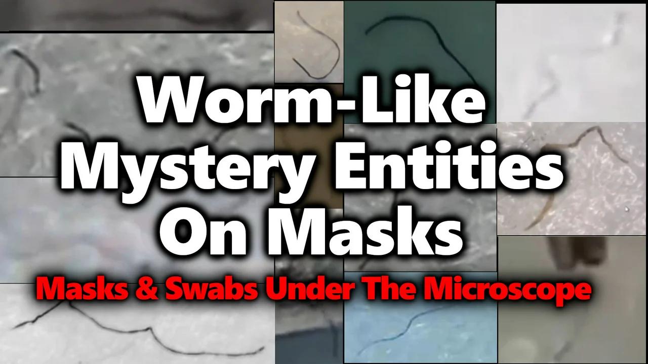 Moving Black Strings On Masks & Swabs: Parasites? Morgellons? Worm-Like ...