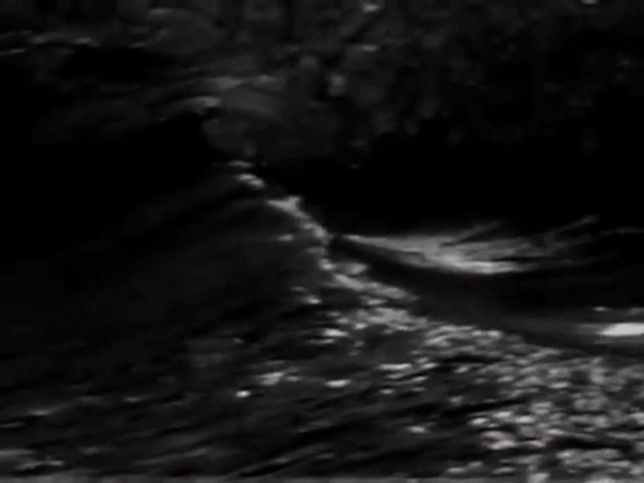 Pearl Jam “Alive”