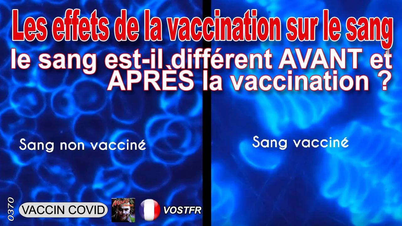 Les effets de la vaccination sur le sang : le sang est-il différent