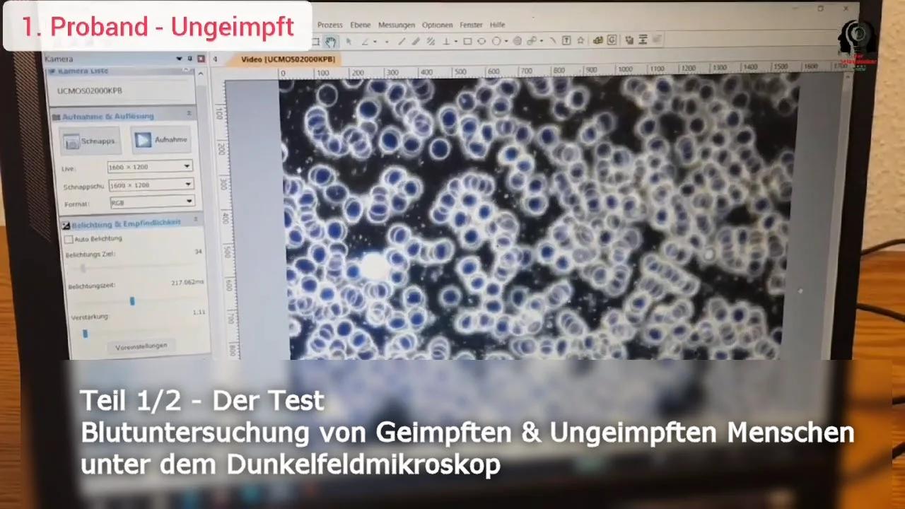 Teil 1/2 Der Test Blutuntersuchung von Geimpften & Ungeimpften Menschen unter
                dem Dunkelfeldmikroskop (Reupload)