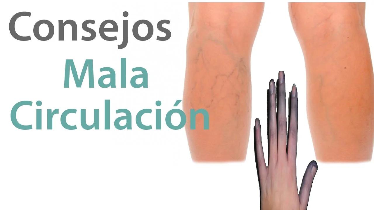 Mala Circulacion Cuidados