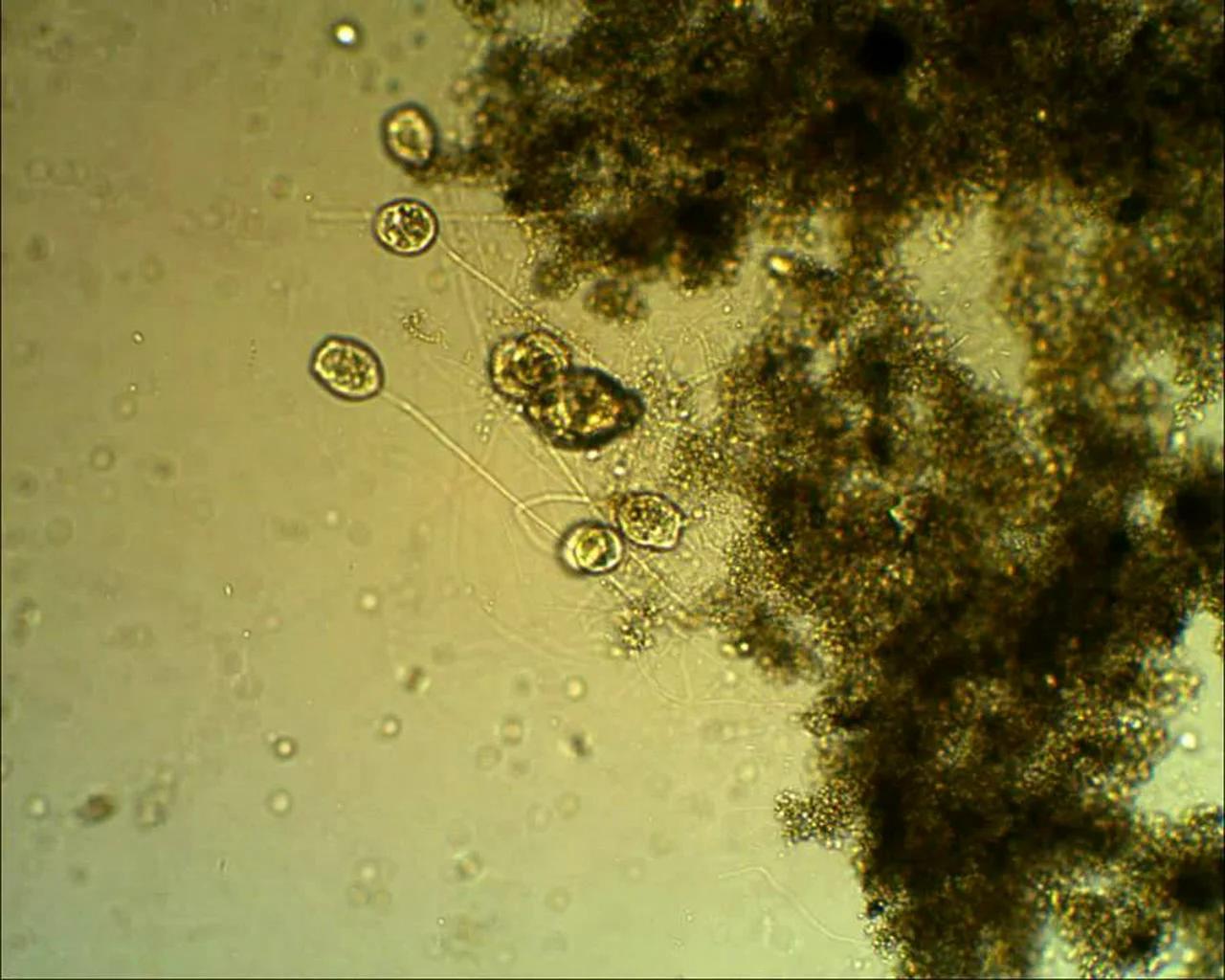 A look at the bacteria in worm tea with a microscope. Video 99
