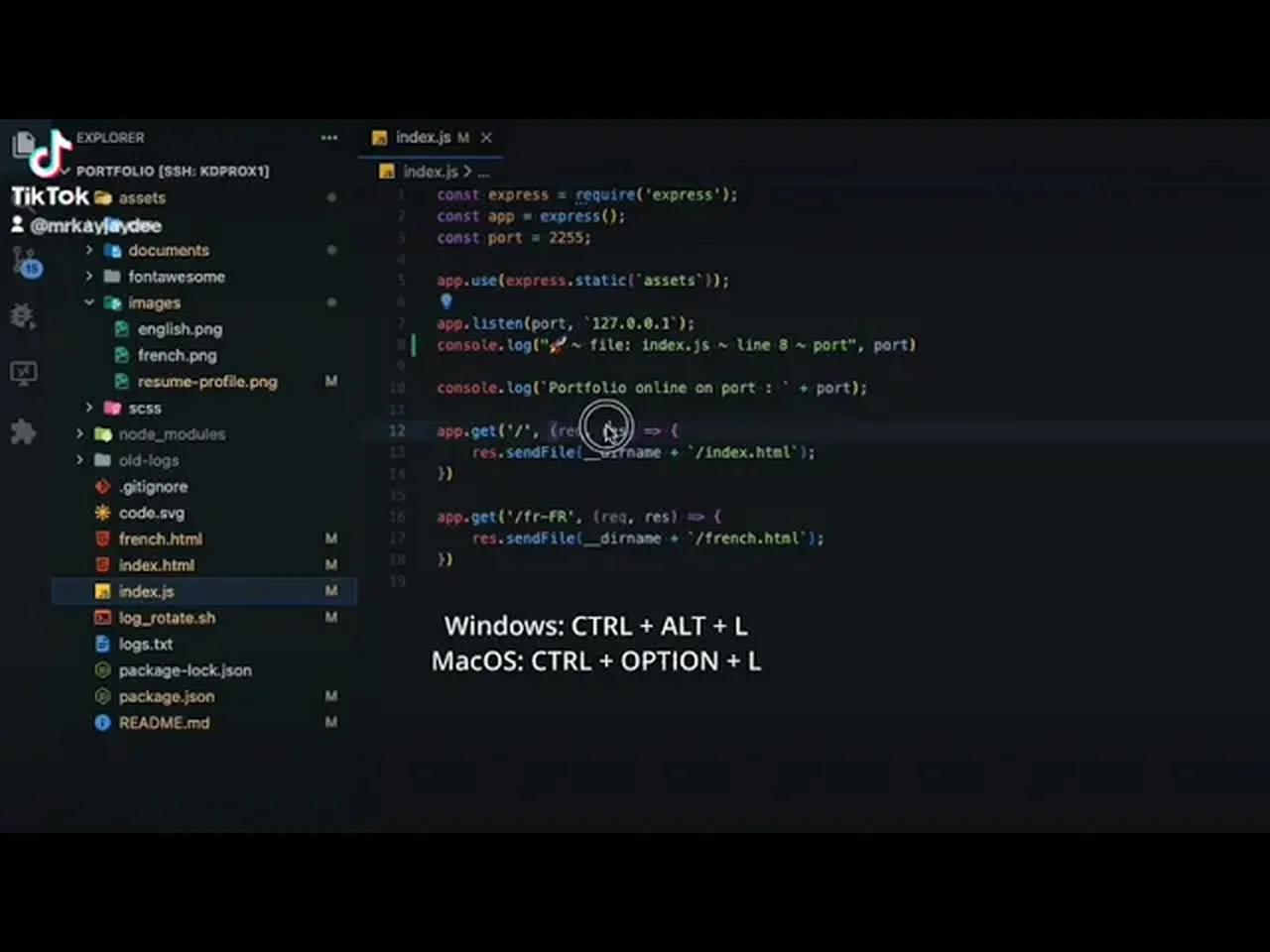 Outil VSCODE - Turbo Console Log