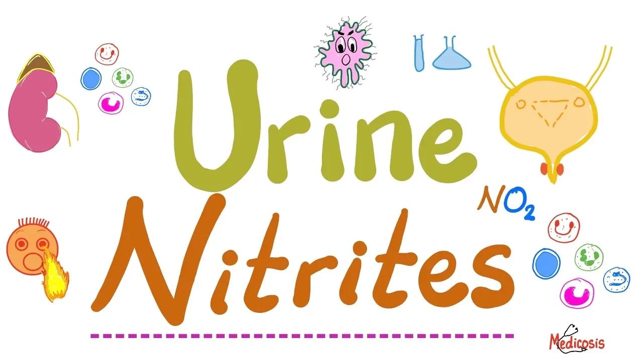 How to diagnose Urinary Tract Infections UTIs Urine Nitrites (Urinalysis) Labs Playlist