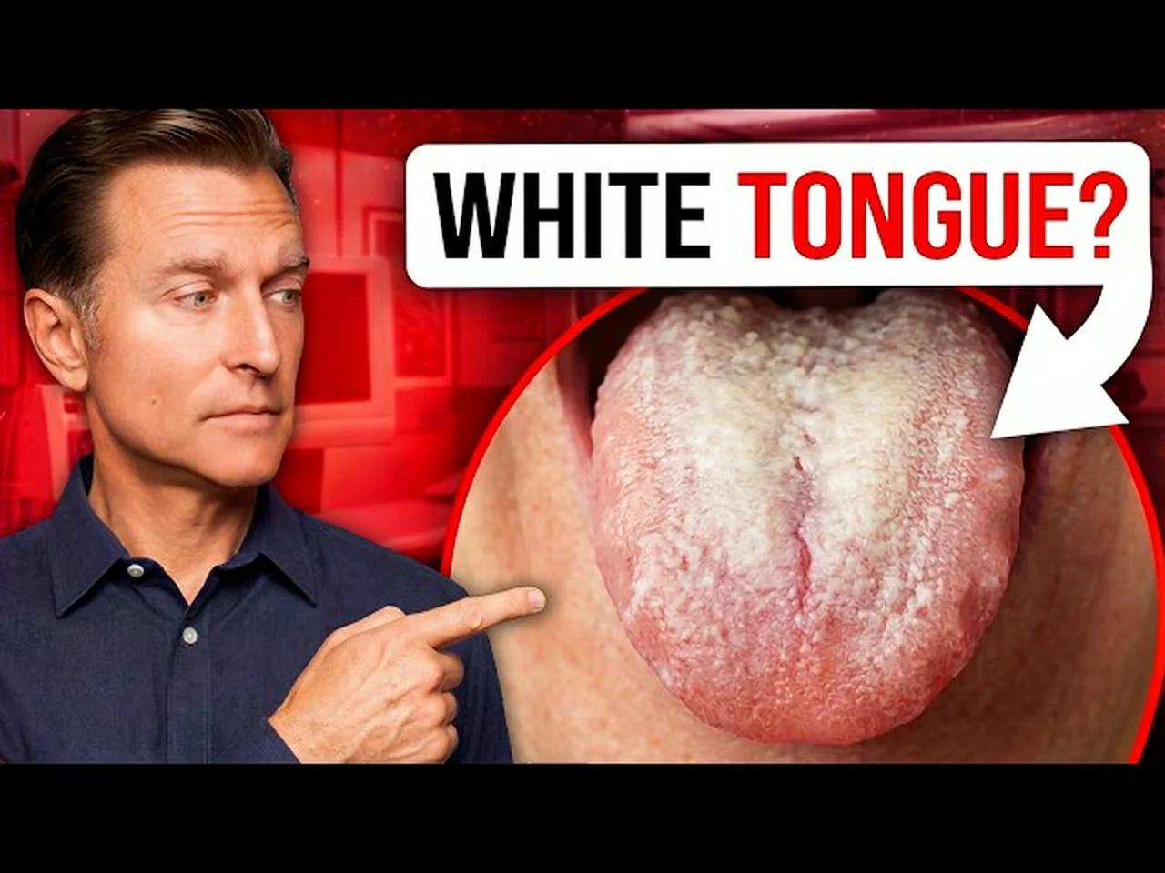 How to Get Rid of Candida in 24 Hours (And Keep It Gone)