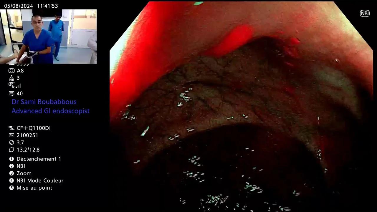 Screening Endoscopy