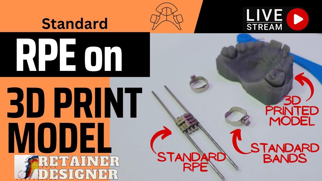 How to make a Standard RPE on a 3D Printed Model