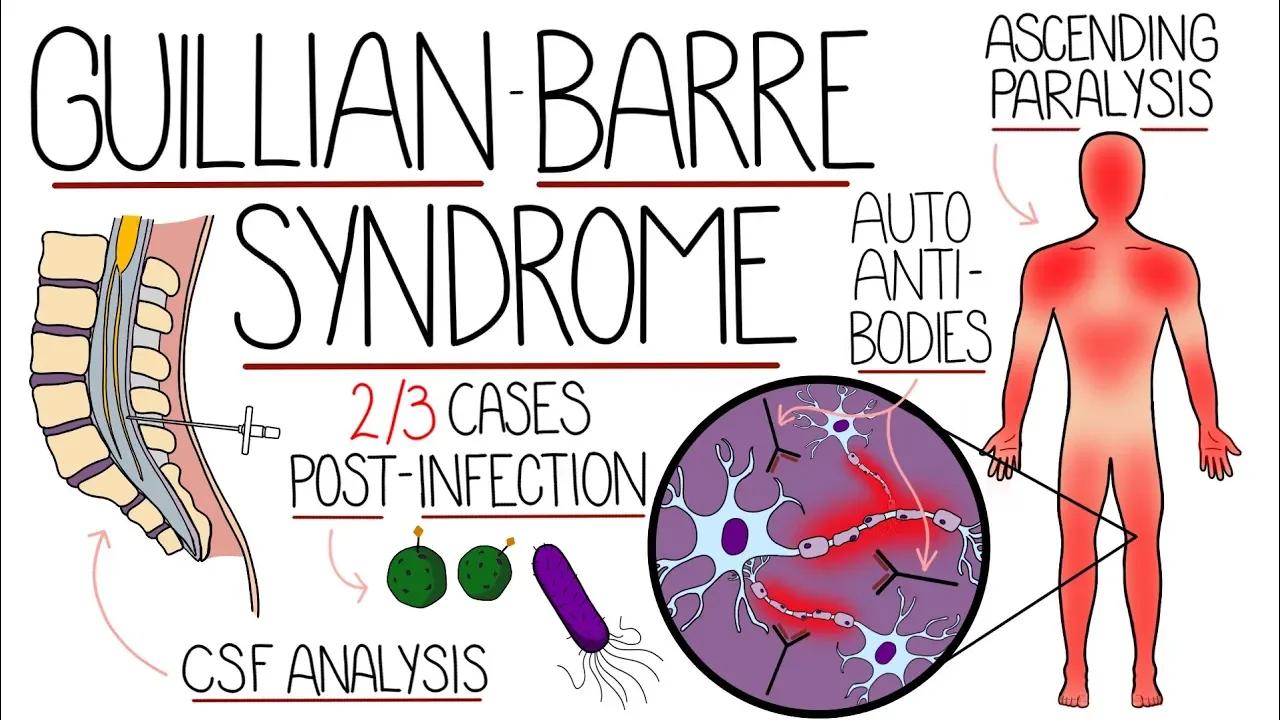 Guillain Barre Explained