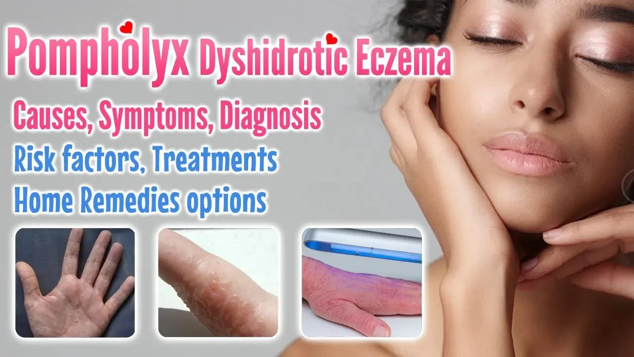 Pompholyx overview, causes, signs, symptoms, treatment option and home ...