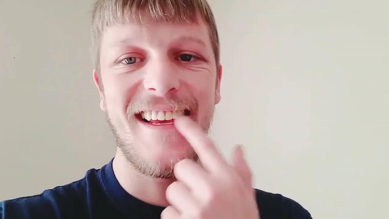 How Dentures Changed My Life The Benefits They Give Me