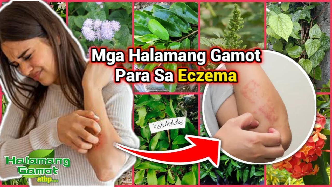 Mga Halamang Gamot Para Sa Eczema | Halamang Gamot ATBP