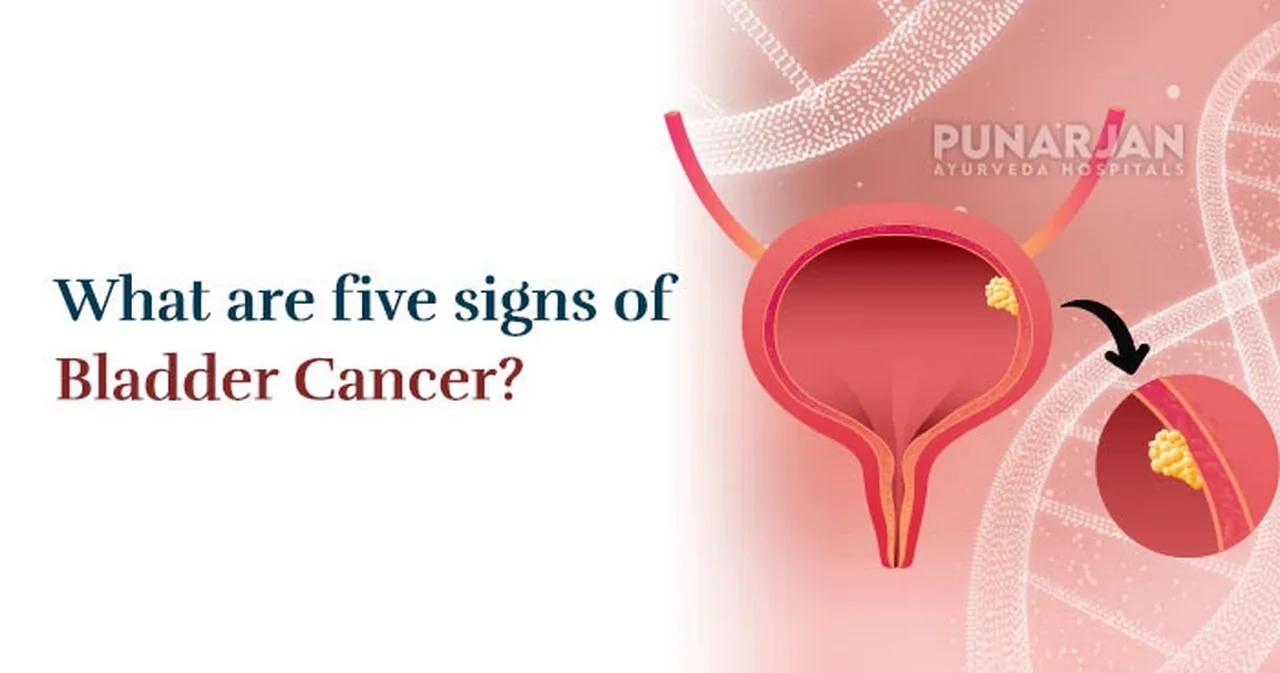 What Are The Five Signs Of Bladder Cancer?