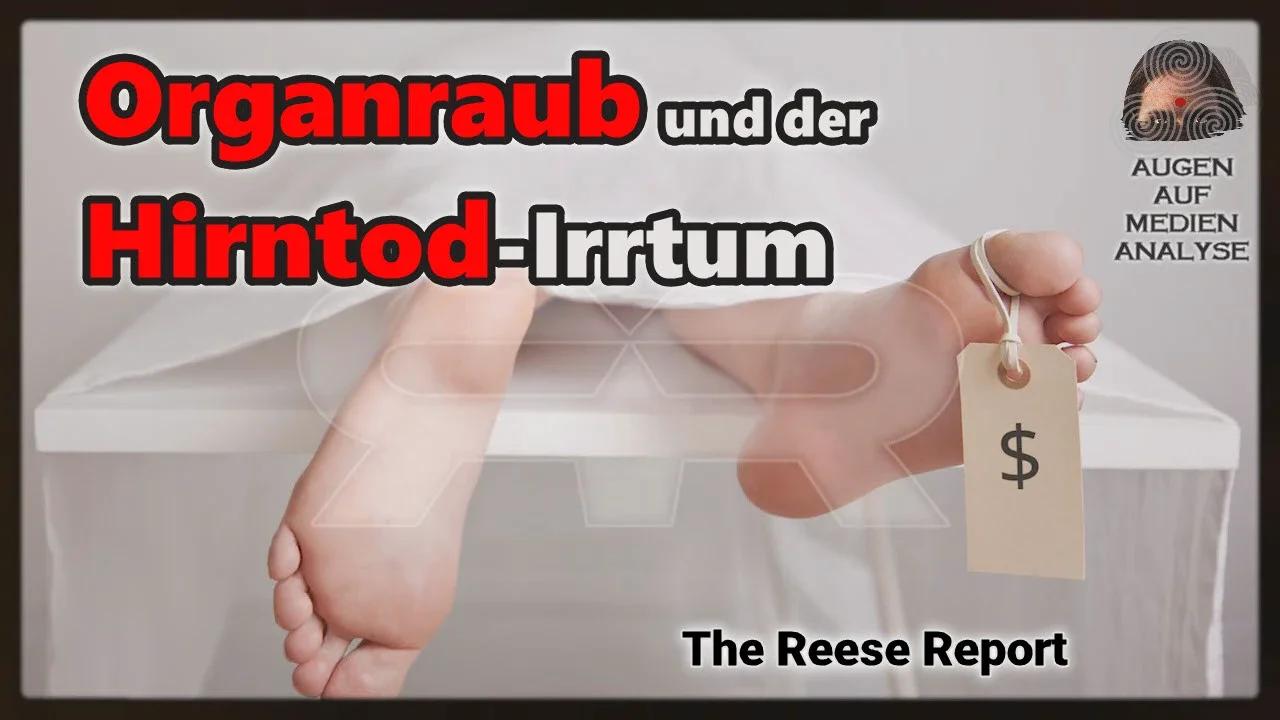 ⁣Organraub und der Hirntod-Irrtum (Reese Report - Deutsch)