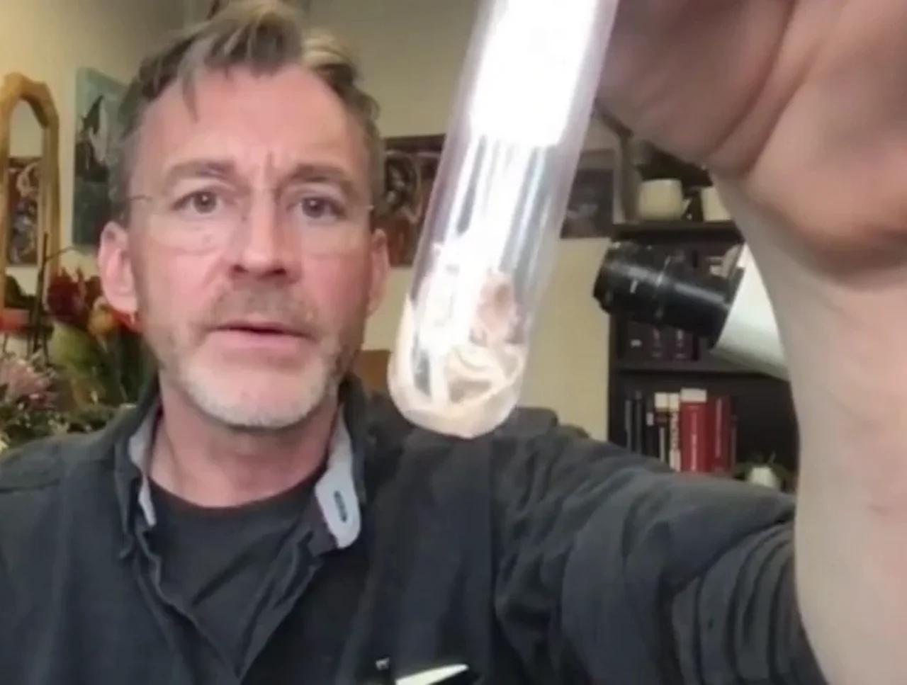 Immediate blood coagulation massive blood clots in vaxxed