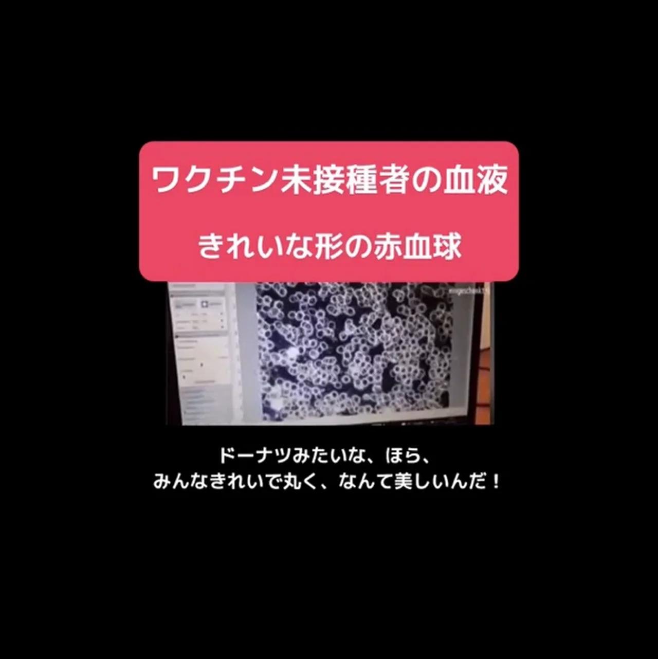 新型コロナワクチン接種者の血液と未接種者の血液の顯微鏡觀察