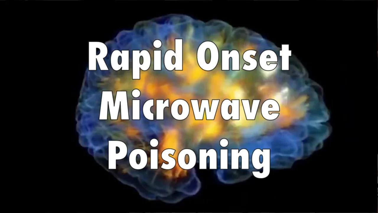 Rapid Onset Microwave Poisoning