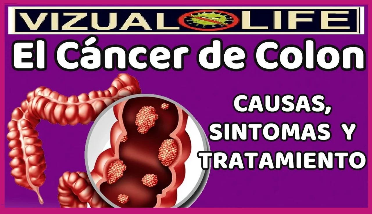 Cancer Colon Cancer Colon