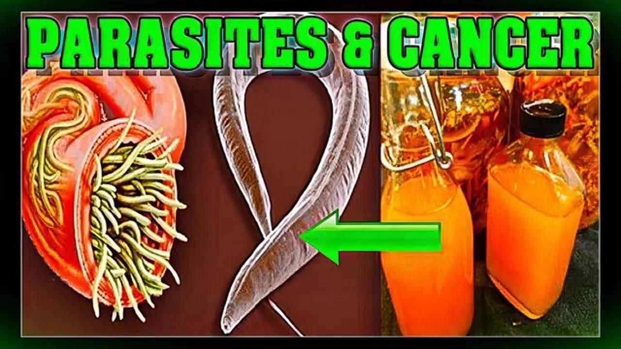 video-proof-cancer-is-caused-by-parasites