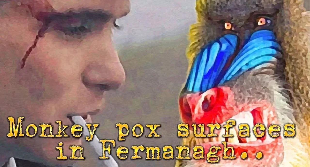 Grandstream: Monkeypox surfaces in Fermanagh 14-11-22