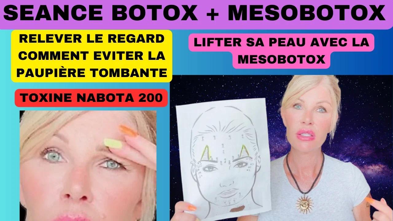 BOTOX:MESOBOTOX NABOTA 200 preparation:dilution: injection #acecosm.com